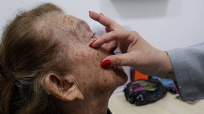 FUnATI lança serviço de TeleDermatologia em parceria com a UFSC e amplia acesso ao diagnóstico especializado no Amazonas